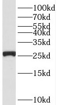 RPS3 antibody|RPS3抗体 FNab07476