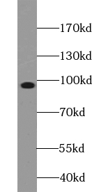 ZNF366 antibody|ZNF366抗体