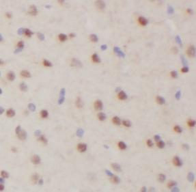 TBR1 antibody|TBR1抗体