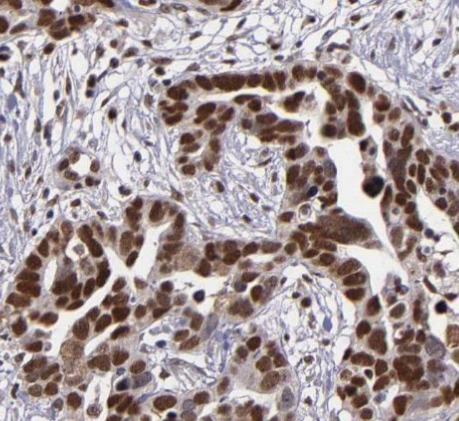 ESR2 antibody|ESR2抗体 FNab02866