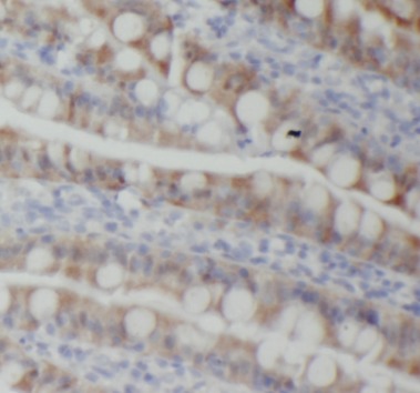 PIGZ antibody|PIGZ抗体