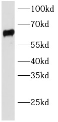 SLC22A6 antibody|SLC22A6抗体 FNa