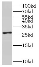 SNRPB2 antibody|SNRPB2抗体