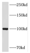 NKRF antibody|NKRF抗体