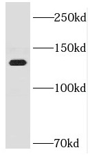HELB antibody|HELB抗体