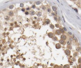 MTOR antibody|MTOR抗体 FNab05417