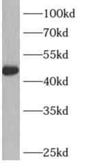 ARFGAP1 antibody|ARFGAP1抗体 FNa
