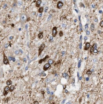 GFAP antibody|GFAP抗体 FNab03428