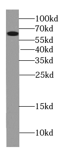 TWNK antibody|TWNK抗体 FNab09115