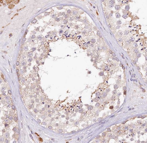 PAPOLG antibody|PAPOLG抗体