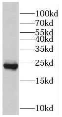 RAB7A antibody|RAB7A抗体