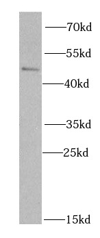 SKAP2 antibody|SKAP2抗体
