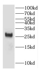 CHCHD6 antibody|CHCHD6抗体