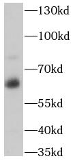 PSAP antibody|PSAP抗体 FNab06844