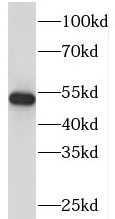 PI4K2B antibody|PI4K2B抗体