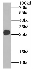 C9orf72 antibody|C9orf72抗体 FNa