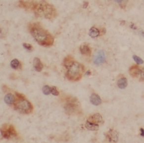 ADCYAP1 antibody|ADCYAP1抗体