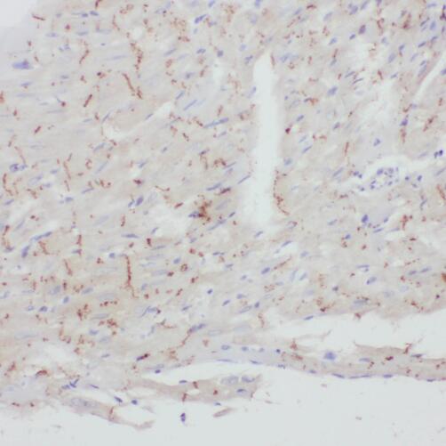 TBL2 antibody|TBL2抗体