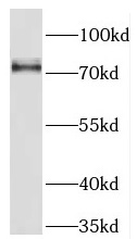 NCDN antibody|NCDN抗体