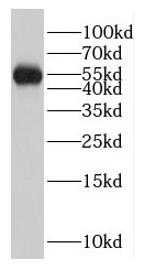 GCK antibody|GCK抗体 FNab03384