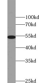 TRIM44 antibody|TRIM44抗体 FNab0