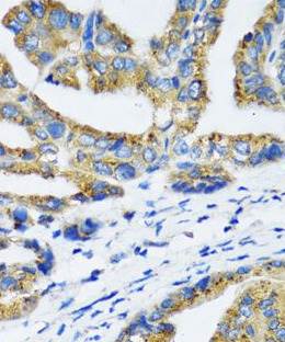 NFKB1 antibody|NFKB1抗体 FNab057