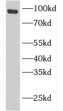 GSN antibody|GSN抗体