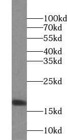 UBE2N antibody|UBE2N抗体 FNab091