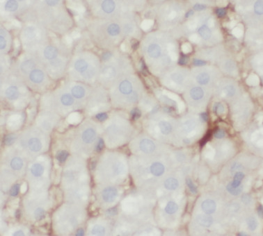SLC2A2 antibody|SLC2A2抗体 FNab0