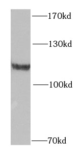 OGDH antibody|OGDH抗体