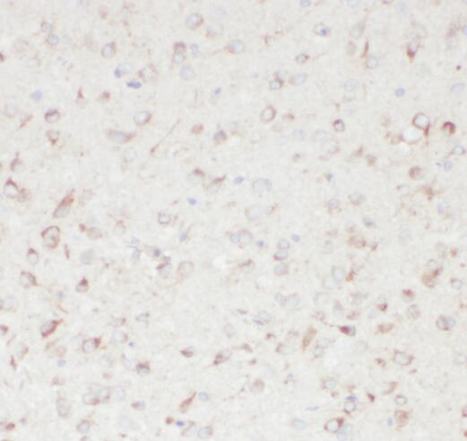 SACM1L antibody|SACM1L抗体