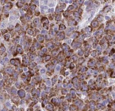 STT3B antibody|STT3B抗体