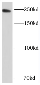 NBAS antibody|NBAS抗体