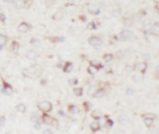 ENO2 antibody|ENO2抗体 FNab05865