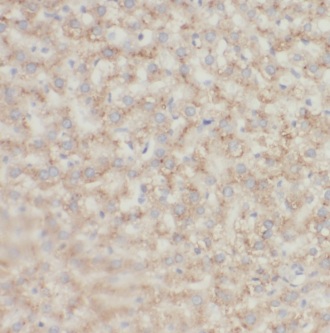 KHDC3L antibody|KHDC3L抗体