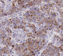 THBS3-Specific antibody|THBS3抗