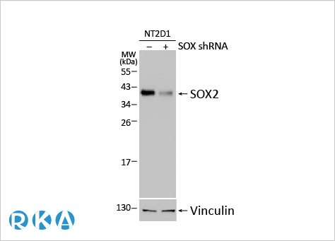 文献速递：细胞外基质硬化与睾丸老化及睾酮水平下降相关