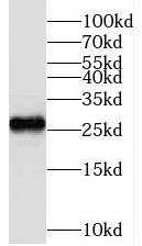 TMEM139 antibody|TMEM139抗体
