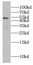 EIF4A3 antibody|EIF4A3抗体 FNab0