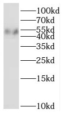 RNH1 antibody|RNH1抗体 FNab07365