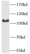 SART1 antibody|SART1抗体