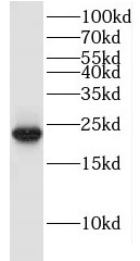 ITPA antibody|ITPA抗体
