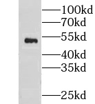 CNDP2 antibody|CNDP2抗体