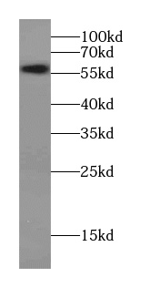 CCT6A-Specific antibody|CCT6A抗