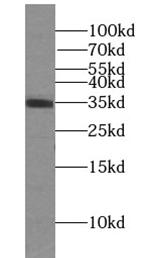 STX11 antibody|STX11抗体