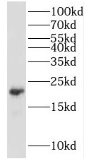 KCNE1 antibody|KCNE1抗体