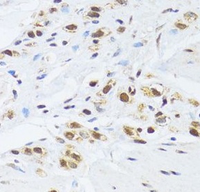 GABPB1 antibody|GABPB1抗体