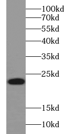 ABHD14B antibody|ABHD14B抗体