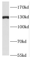 RAB3GAP1 antibody|RAB3GAP1抗体