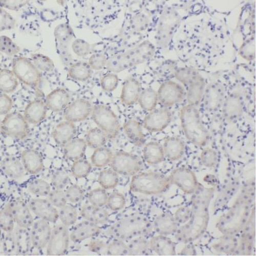 TEX12 antibody|TEX12抗体